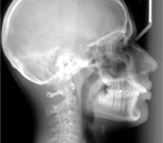 Cephalometric X-ray